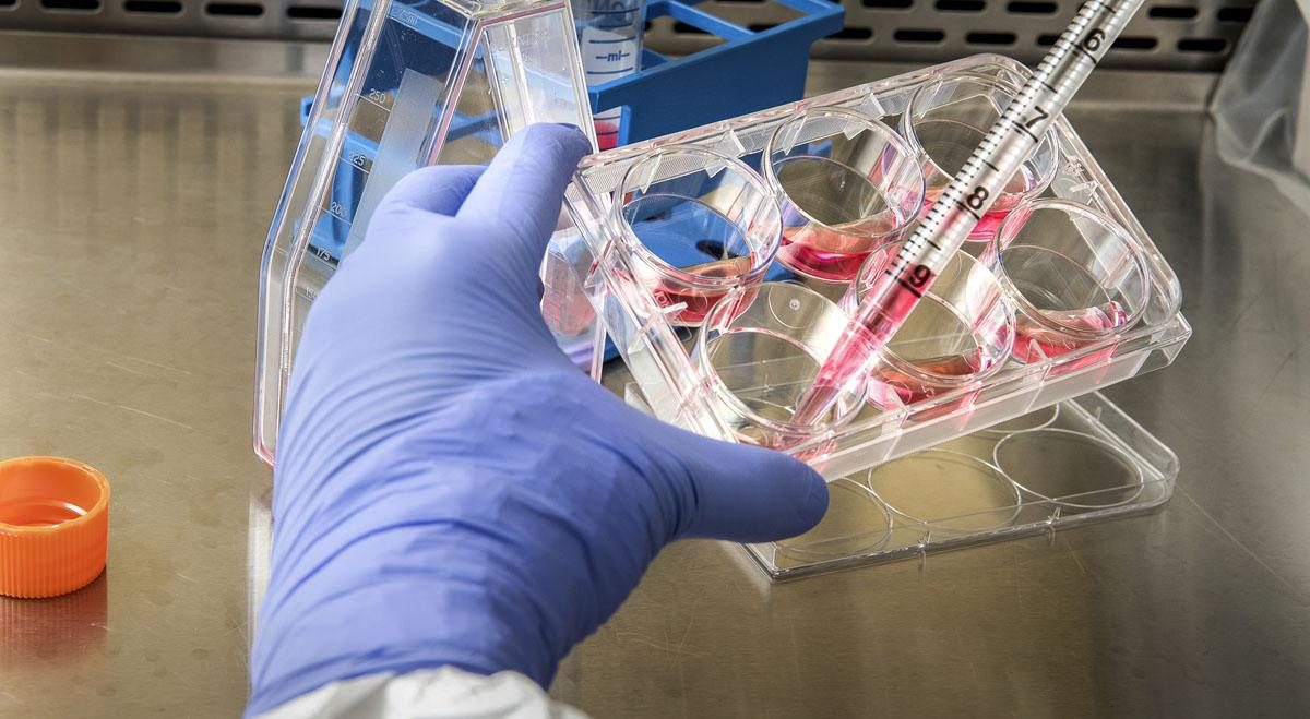LeonaBio beats Q2 loss forecast as Phase 3 ELAINE-3 trial advances