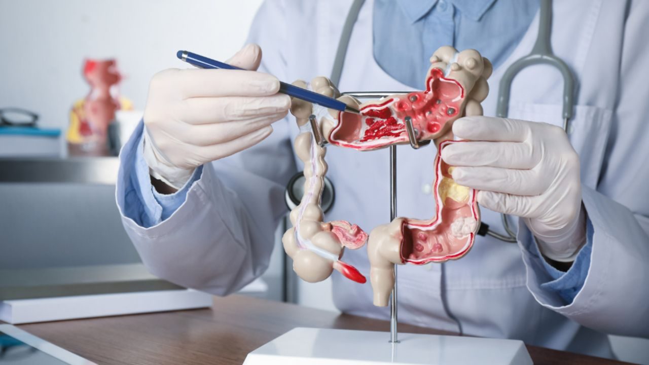 Agenus shares surge as company secures up to $340M to advance colon cancer trial