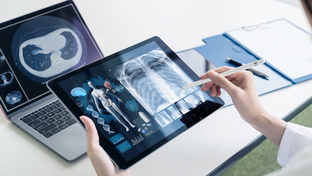 Teledyne agrees to acquire Varex Imaging for $1.1bn