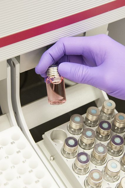 Claude AI Says Market is Ignoring Ardelyx (ARDX) Growth Catalysts
