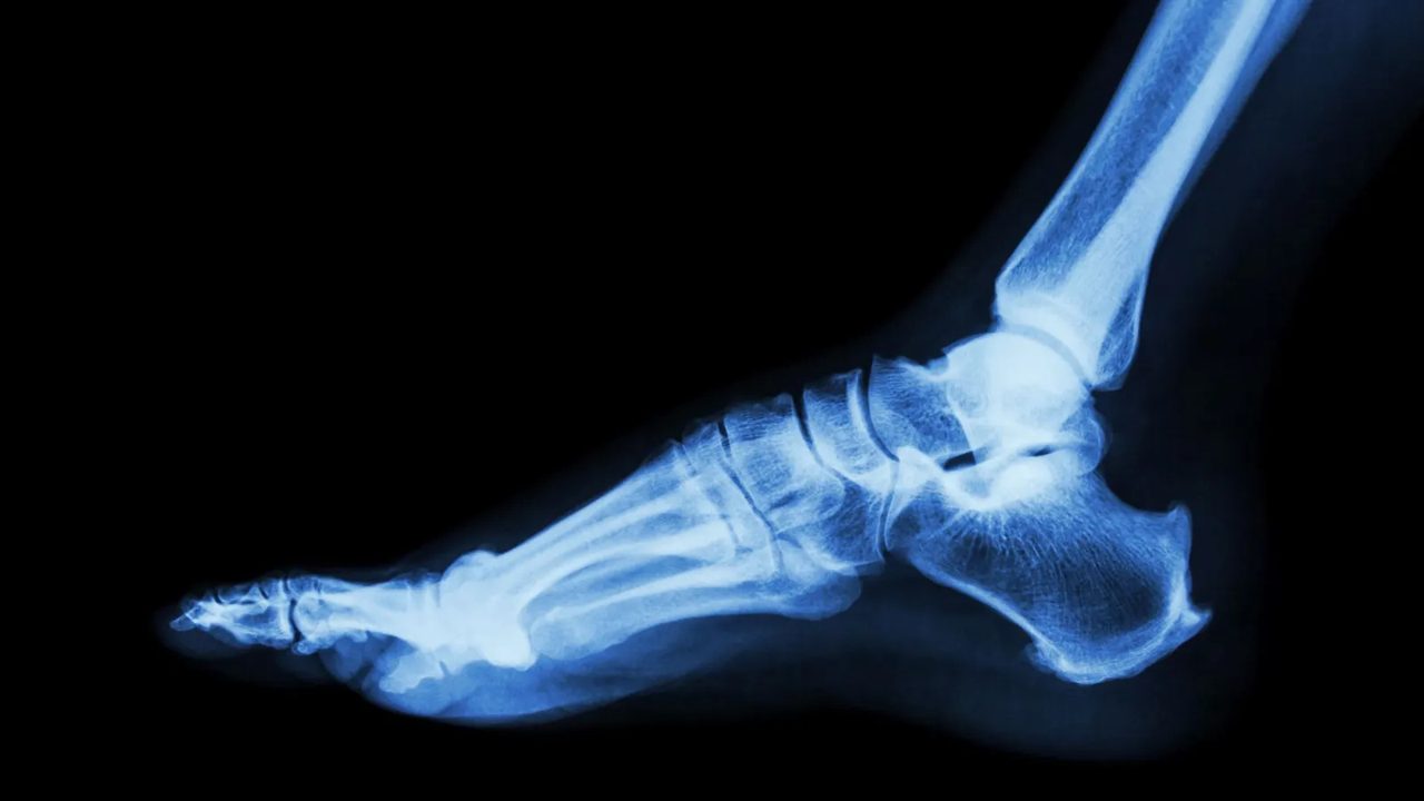Teledyne inks $1.1B takeover of Varex Imaging